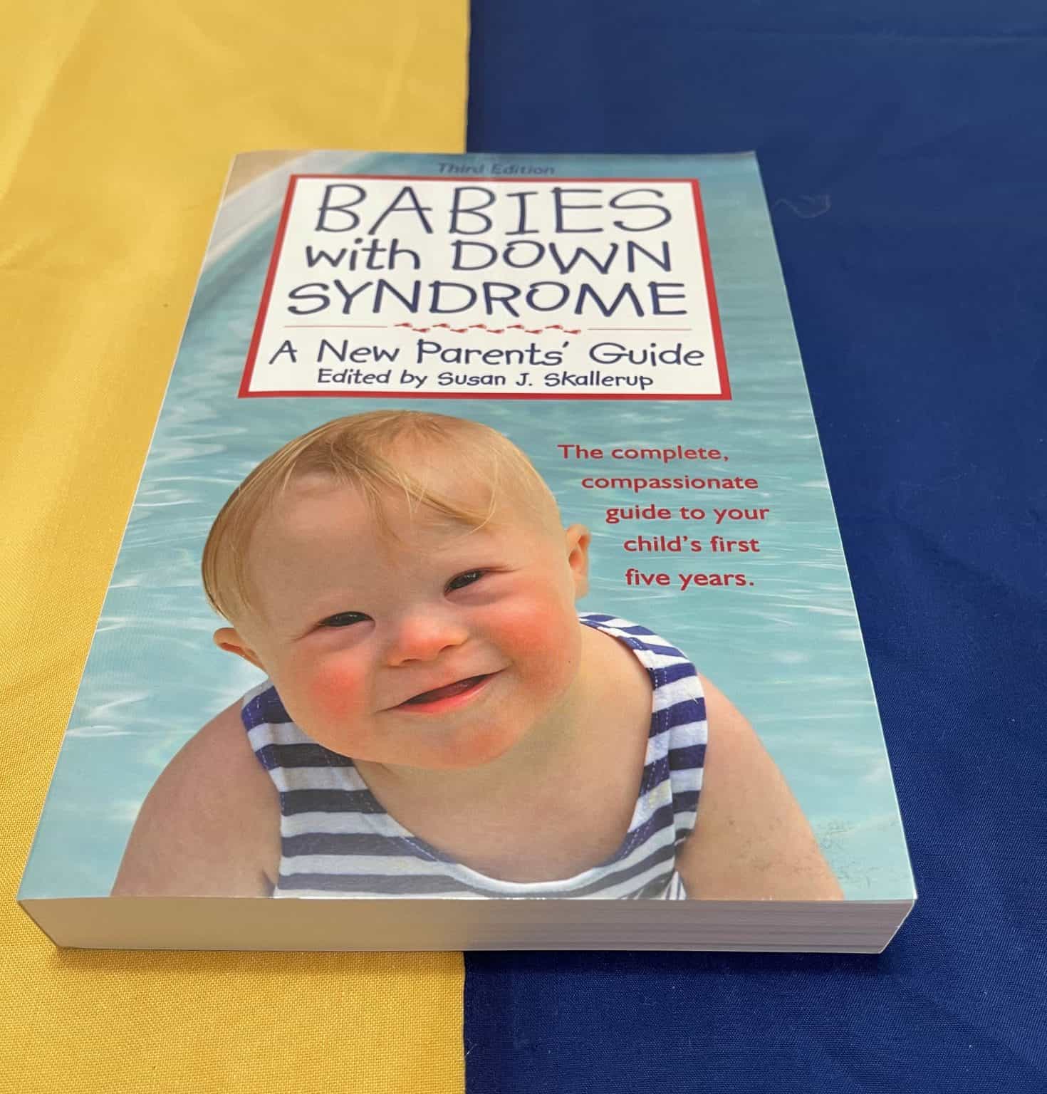 Babies with Down Syndrome - Shop & Support the LDSA